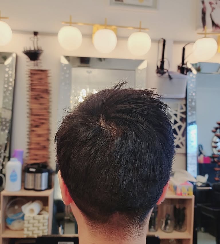 Close-cropped dark haircut shown from the back